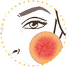 Blephademodex servetter mot demodex